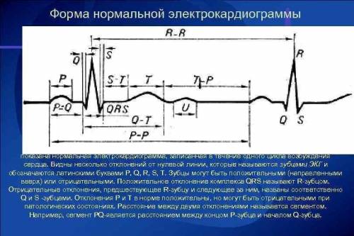 Что означают P, Q, R, S, T?