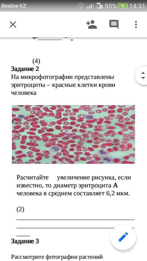 На микрофотографии представлены эритроциты – красные клетки крови человека Расчитайте увеличение рис