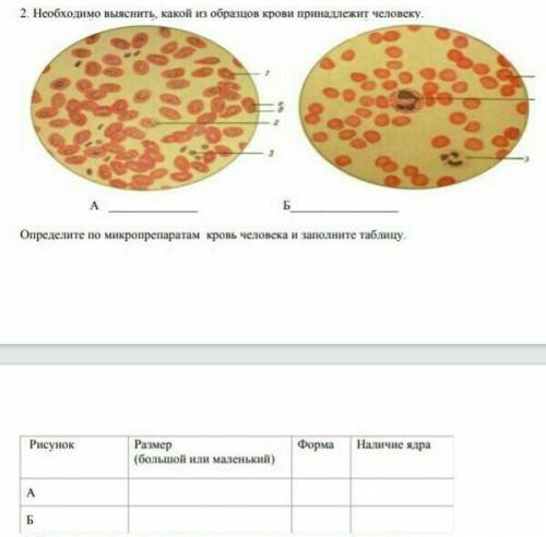 Необходимо выяснить какой из образцов крови принадлежит человеку у меня сор