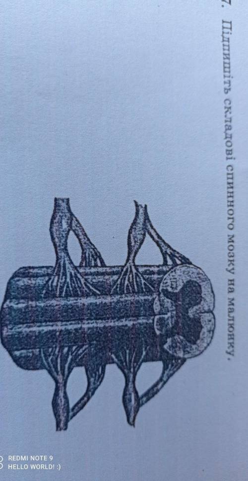Підпишіть складові спинного мозку на малюнку