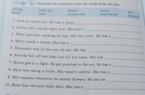 1. Complete the sentences with the words from the box. allergyfeverblack eyerashblisterrunny nosebum